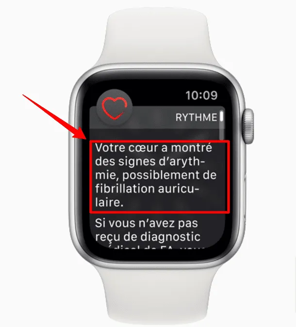 possible probleme capteur rythme cardiaque apple watch